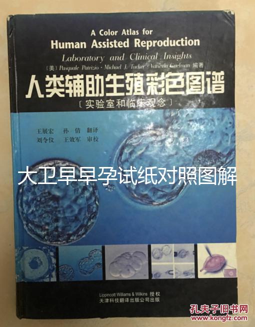 大衛(wèi)早早孕試紙對(duì)照?qǐng)D解，教你怎么看結(jié)果是不是陽(yáng)性