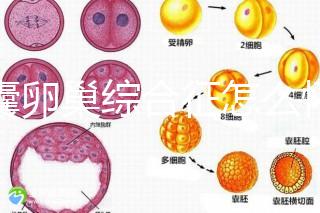 多囊卵巢綜合征怎么懷孕？試管嬰兒并不是唯一方案