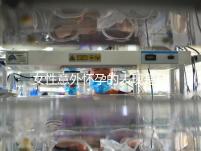 女性意外懷孕的表現(xiàn)是什么？