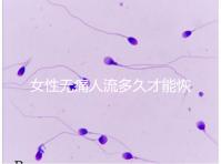 女性無痛人流多久才能恢復(fù)健康？