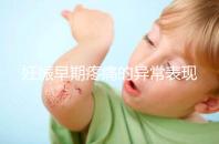 妊娠早期疼痛的異常表現(xiàn)是什么？