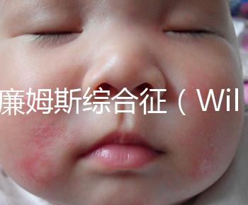 威廉姆斯綜合征（Williams syndrome）是遺傳的嗎?