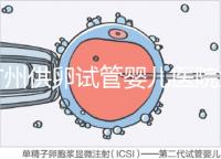 廣州供卵試管嬰兒醫(yī)院匯總，真實(shí)案例告訴你廣東哪家最好