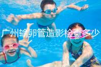 廣州輸卵管造影檢查多少錢，預(yù)約時間一次說清楚，想去看