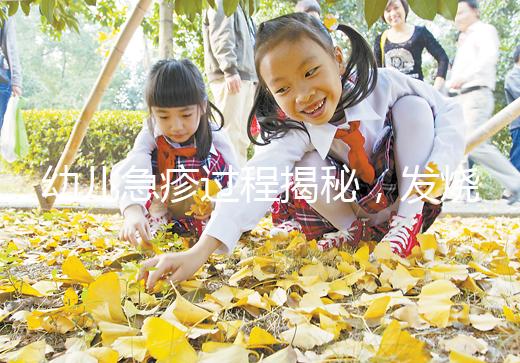 幼兒急疹過程揭秘，發(fā)燒規(guī)律和退疹時間全都有！