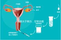 選擇大于努力，空軍總醫院做試管嬰兒必讀攻略