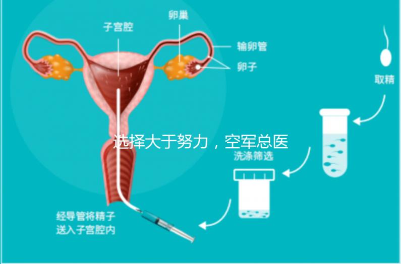 選擇大于努力，空軍總醫院做試管嬰兒必讀攻略