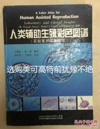 選購美可高特前猶豫不絕，該款羊奶粉品牌質量賣點介紹