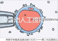 重慶婦幼人工授精一次成功率揭秘，移植費(fèi)用貴有原因