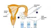 降調(diào)，進周，囊胚……這些試管嬰兒助孕術(shù)語你都懂嗎？