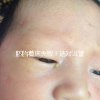 胚胎著床失敗？選對試管嬰兒醫(yī)生很重要