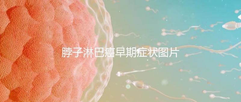 脖子淋巴癌早期癥狀圖片（脖子上有結(jié)節(jié)的圖片）