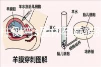 脊柱側(cè)彎s型懷孕莫慌張，能否順產(chǎn)還得看這4大要素