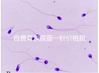 自費脊灰疫苗一針價格超200！與免費糖丸相比各有優(yōu)缺點