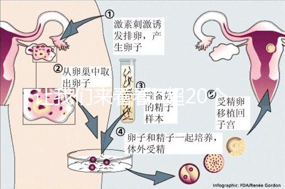讓我們來看看b超20個卵子取10個是不正常的我們該怎么辦？