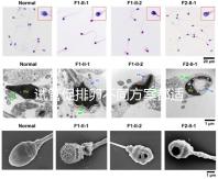 試管促排卵不同方案都適合哪些人？如何監(jiān)測排卵？