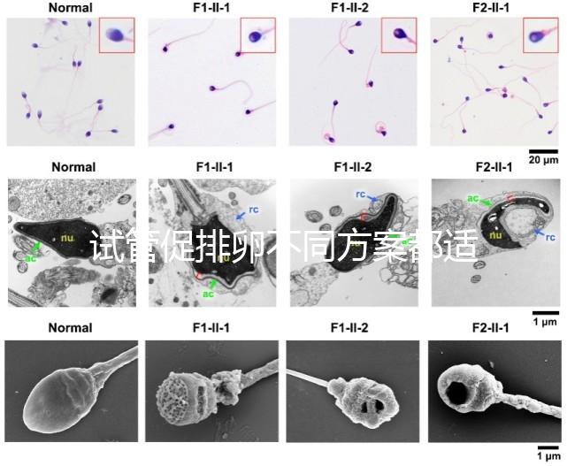 試管促排卵不同方案都適合哪些人？如何監測排卵？