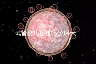 試管嬰兒移植懷孕14天，還能吃巧克力餅干嗎？