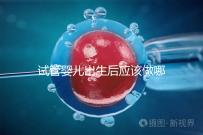 試管嬰兒出生后應該做哪些檢查答案？DR應該看情況嗎？