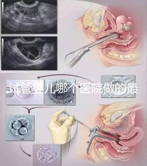 試管嬰兒哪個醫(yī)院做的最好呢？多家權(quán)威機構(gòu)推薦