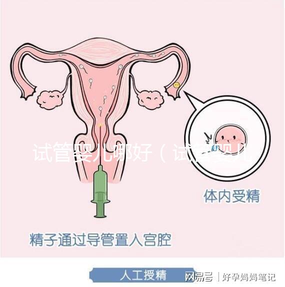 試管嬰兒哪好（試管嬰兒權(quán)威醫(yī)院哪家最好）