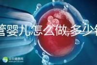 試管嬰兒怎么做,多少錢？試管操作流程詳解及周期預估