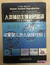 試管嬰兒怎么選擇性別（試管嬰兒怎么選擇性別的）