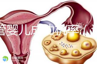 試管嬰兒成功機(jī)率（試管嬰兒成功機(jī)率有多少）