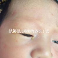 試管嬰兒壽命有多長（試管嬰兒壽命有多長時間）