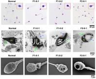 試管嬰兒費用是多少錢（試管嬰兒費用是多少錢一次）