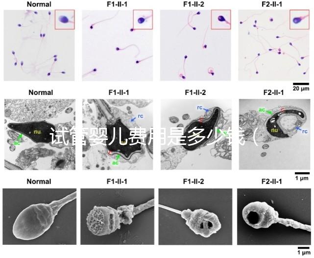 試管嬰兒費(fèi)用是多少錢（試管嬰兒費(fèi)用是多少錢一次）