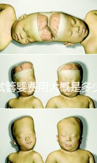 試管嬰費用大概是多少