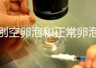 辨別空卵泡和正常卵泡是有技巧的，只需要了解這四個方面就可以輕松辨別，快速學習！