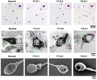 預約方便，成本低！2024年西安新城、臨潼、雁塔四維彩超指南