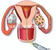 馬來西亞 試管嬰兒（馬來西亞試管嬰兒和泰國比較哪個更好）