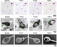 33歲卵泡發育不良，做試管黃體期促排方案失敗怎么辦？