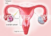 39歲四促四移，試管移植失敗5次后應該怎么辦？
