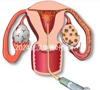 2024武漢免費葉酸外國人可以領(lǐng)取，符合條件就來江漢區(qū)