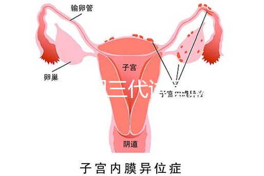 2025昆明三代試管助孕費(fèi)用一覽，8-15萬元，價格透明公開自主選擇