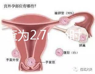 nt檢查為2.7mm時危險性莫亂猜，做完無創后才能確定